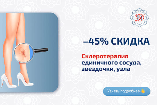 Склеротерапия Акция