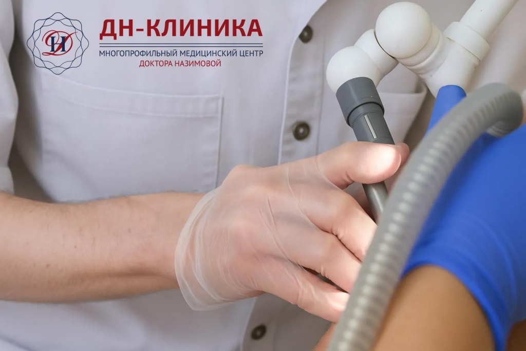 Методы удаления кондилом