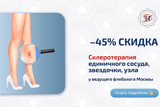 Склеротерапия Акция