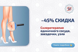 Склеротерапия Акция