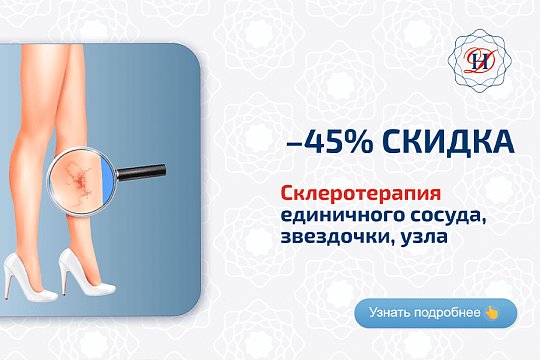 Склеротерапия Акция